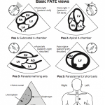 FATEcard